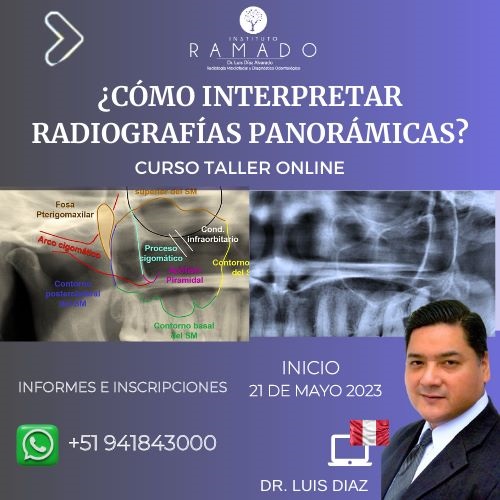 ¿CÓMO INTERPRETAR RADIOGRAFÍAS PANORÁMICAS?